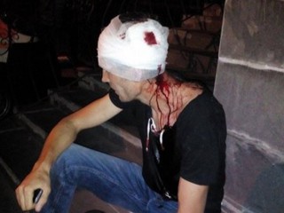 В Ирпене избили активиста